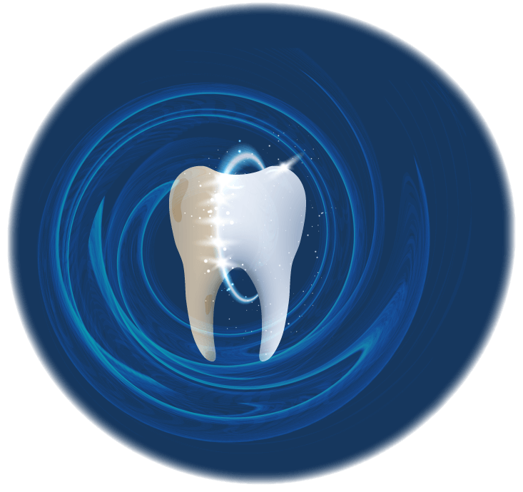 I consigli del dentista sullo sbiancamento dei denti