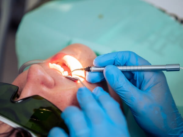 Che cos’è il Laser e il suo utilizzo in Odontoiatria